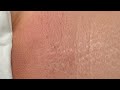 Brazilian waxing tutorial #brazilianwax #bikiniwax