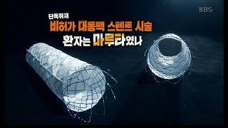 [풀영상] KBS 추적60분_단독취재 비허가 대동맥 스텐트 시술 환자는 마루타였나_20190524