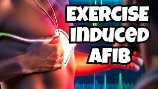 Exercise Induced AFib: Expert Tips