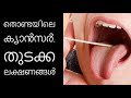 ക്യാന്‍സറിന്റെ ചില തുടക്കലക്ഷണങ്ങള്‍ health tips malayalam