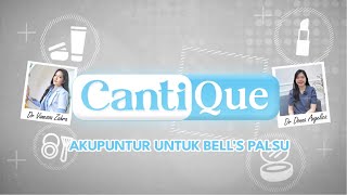 Akupuntur Untuk Bell's Palsu | Cantique