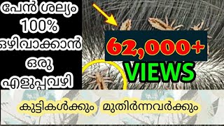 How to get rid of Lice || പേൻ ശല്യം ഒഴിവാക്കാൻ ഒരു ഉഗ്രൻ വഴി|| Head Lice Treatment || Natural Way