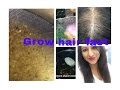 Best home remedy for Hair Regrowth for bald hair patches ( not for PITTA DOSHA) Best home remedy for Hair Regrowth for bald hair patches ( not for PITTA DOSHA)