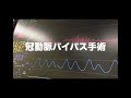 心臓血管外科医が紹介する、手術に使う道具7選！＜後編＞※手術シーンあり