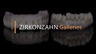 Screw-retained lower jaw, upper jaw with friction coping on a bar | Zirkonzahn.Galleries