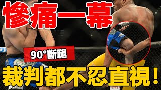 UFC太危險！開賽僅5秒名將90度斷腿，對手跪地不敢看，一身冷汗！[综合格斗]