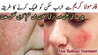 Face Redness Treatment at Home | Chehre Ki Redness Khatam Karne Ka Tarika | Damage Skin Repair