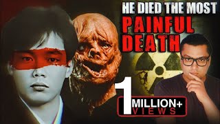 рд╡реЛ рдЕрдкрдиреЗ рдорд░реЗ рд╢рд░реАрд░ рдореЗрдВ 83 Days рддрдХ рддрдбрд╝рдкрддрд╛ рд░рд╣рд╛ The Most Painful and Scary Story of Hisashi Ouchi