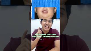 PERBEDAAN GONDONGAN DAN GONDOKAN #yangfarhantahu #youtubehealth