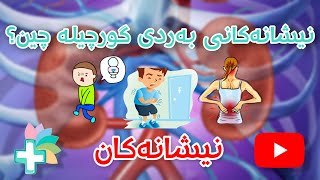 نیشانەکانی بەردی گورچیلە چین ؟ - نیشانەکان