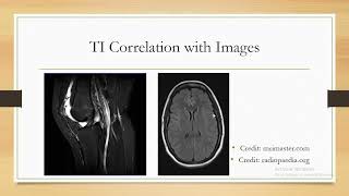 Inversion Time (TI) in MRI by Habibur Rahman