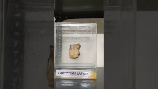 Museum specimen| நோயியல் அருங்காட்சியகம் | #museum #sample #histomuseum #histopathology