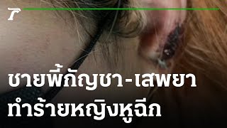 ชายพี้กัญชา-เสพยา คลั่งทำร้ายหญิงใบหูฉีกขาด | 16-06-65 | ข่าวเย็นไทยรัฐ