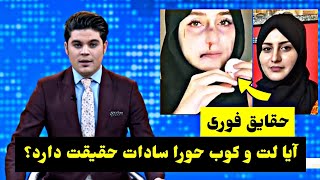 خبر تازه: حقیقت ز/خمی شدن حورا سادات و فعالیت های سید ظریف بابا / طلوع نیوز / Tolonews