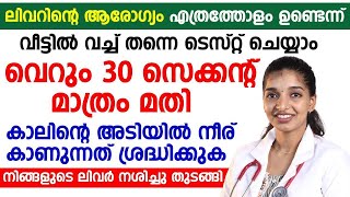 ലിവറിന്റെ ആരോഗ്യം വെറും 30 സെക്കൻഡ് കൊണ്ട് വീട്ടിൽ വെച്ച തന്നെ ടെസ്റ്റ് ചെയ്യാം