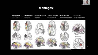 Center for NeuroTechnology Research Seminar - Michael Sughrue, M.D.