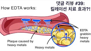 댓글 리뷰 #39: 동맥경화증에 킬레이션 치료가 효과 있을까?!