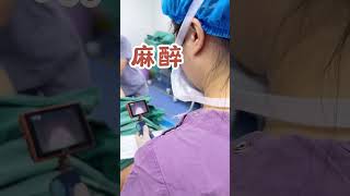 腰腹环吸 #facelift #fyp #plastic #吸脂 #viral #liposuction