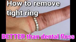 Remove STUCK ring!!