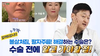 볼살처짐,팔자주름! 해결하는 수술은? 수술전에 알고가세요!