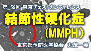 TCC-159：MMPH（結節性硬化症）