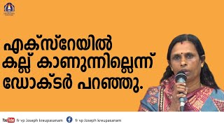 എക്‌സ്‌റേയിൽ കല്ല് കാണുന്നില്ലെന്ന് ഡോക്ടർ പറഞ്ഞു