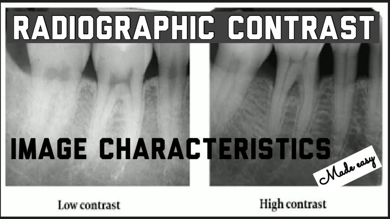 RADIOGRAPHIC CONTRAST II IMAGE CHARACTERISTICS II IDEAL RADIOGRAPH II ...