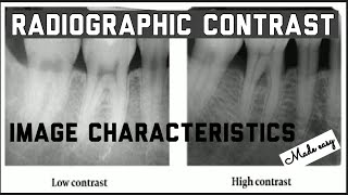 RADIOGRAPHIC CONTRAST II IMAGE CHARACTERISTICS II IDEAL RADIOGRAPH II ORAL RADIOLOGY