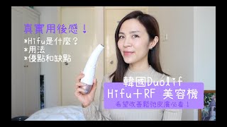 【真實用後感】Duolif Hifu ＋ RF 美容機｜抗衰老好幫手｜用法｜好處壞處｜