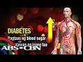 Tips para makaiwas sa diabetes