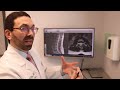 what is a herniated disc explained by dr. peter d amore from orthopaedic center of south florida