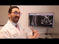 what is a herniated disc explained by dr. peter d amore from orthopaedic center of south florida