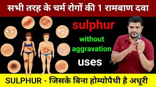 Sulphur is a homeopathic medicine for all skin problems. How to use it without aggravation?#sulphur