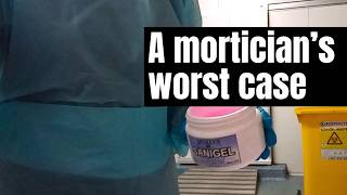 A mortician's worst ever case