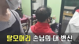 헤어스타일만 바꿨을 뿐인데 탈모 머리의 변신