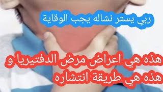 هذه هي اعراض مرض الدفتيريا و هذه هي طريقة انتشاره بين الأشخاص الحذر مطلوب