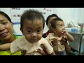 sight saving operation on baby twin boys in laos report by ray martin