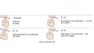 【骨科物理治疗评估】05肩关节｜特殊测试①