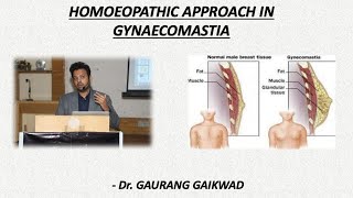 Homoeopathic Approach in Gynaecomastia - Dr Gaurang Gaikwad