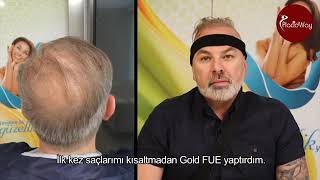 The Best Hair Transplantation at EsteCenter, Istanbul, Turkey