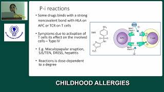 Childhood Allergies by Dr Dhanushka Dassanayake & Professor P K Vedanthan