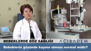 Bebeklerin gözünde kayma olması normal midir ?