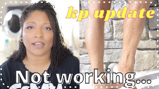 Keratosis Pilaris update 1 | Products for KP, Chicken Skin, Bumpy Skin, Dry Skin | On Arms, legs