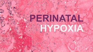 Perinatal Hypoxia