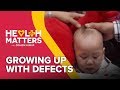 Health Matters: Growing Up With Defects