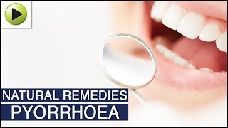 Pyorrhea (Pyorrhoea) - Natural Ayurvedic Home Remedies