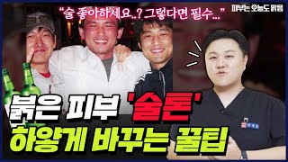 이대로 살 순 없다! 술자리만 가면 얼굴 빨개지는 '술톤'의 해결법 | 피부과의사가 알려주는 꿀팁