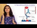 western blotting technique principle step by step in hindi