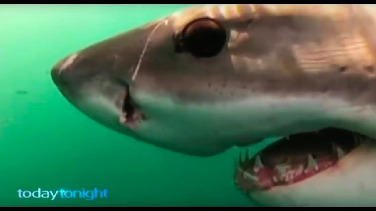 Shark Attack Survivor - Part 1, 2, 3 - YouTube