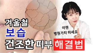 건조한 겨울철 속건조 해결법!  보습제 많이❌피부과❌이 방법대로 하세요!